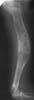 Изображение - Лучевая диагностика костей и суставов k001s