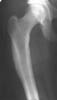 Изображение - Лучевая диагностика костей и суставов k003s