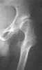 Изображение - Лучевая диагностика заболеваний костей и суставов k005s
