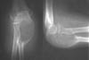 Изображение - Лучевая диагностика заболеваний костей и суставов k006s