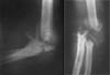 Изображение - Лучевая диагностика заболеваний костей и суставов k013s
