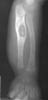 Изображение - Лучевая диагностика заболеваний костей и суставов k016s